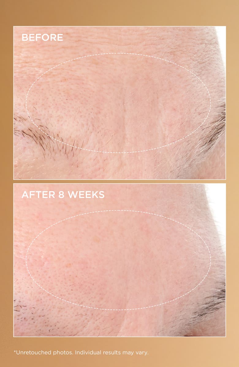 Perricone MD Neuropeptide Deep Crease Serum, Alternate, color, 