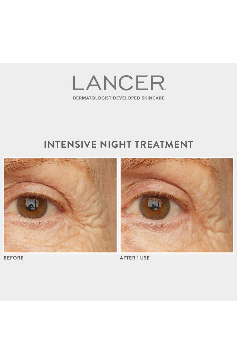LANCER Skincare Intensive Night Treatment, Alternate, color,