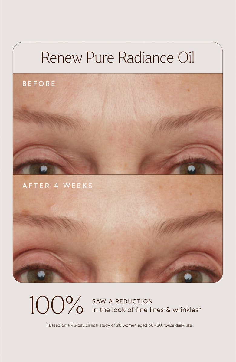 True Botanicals The True Botanicals Effect Set $214 Value, Alternate, color, 