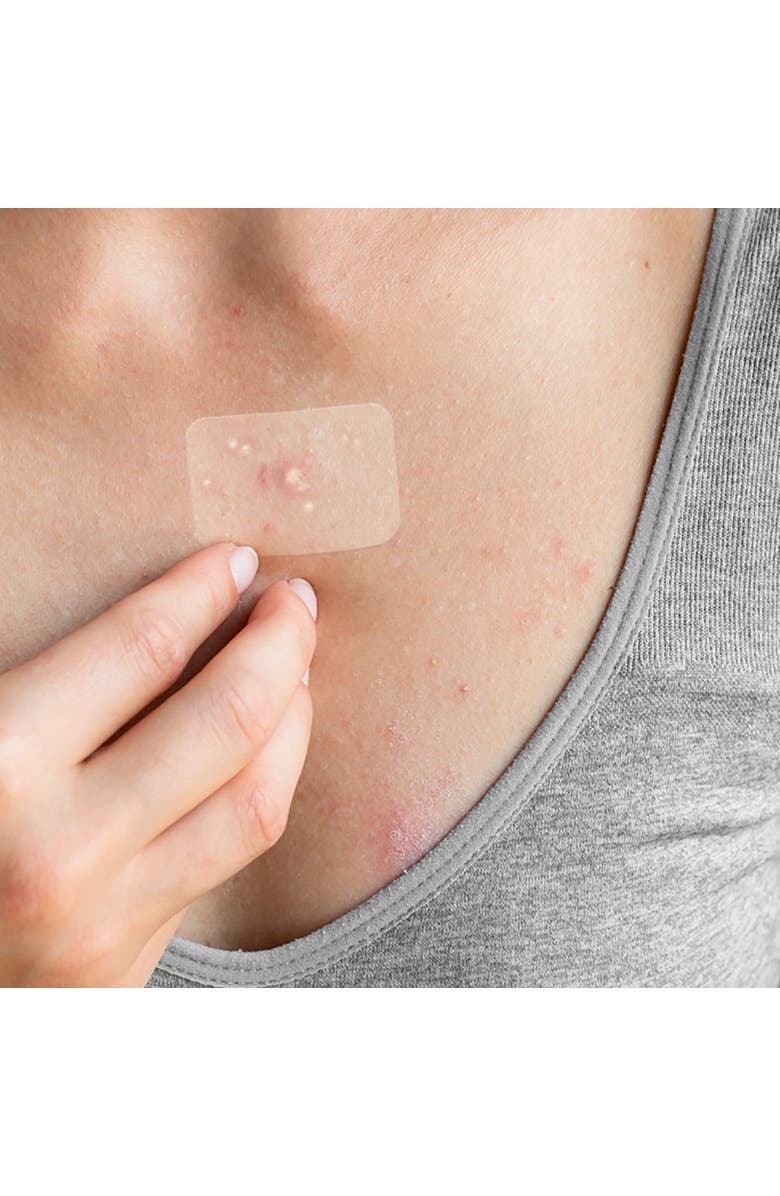 TRULY CLEAR Target Patches, 42 Count, 4 Sizes, Alternate, color, Multicolored