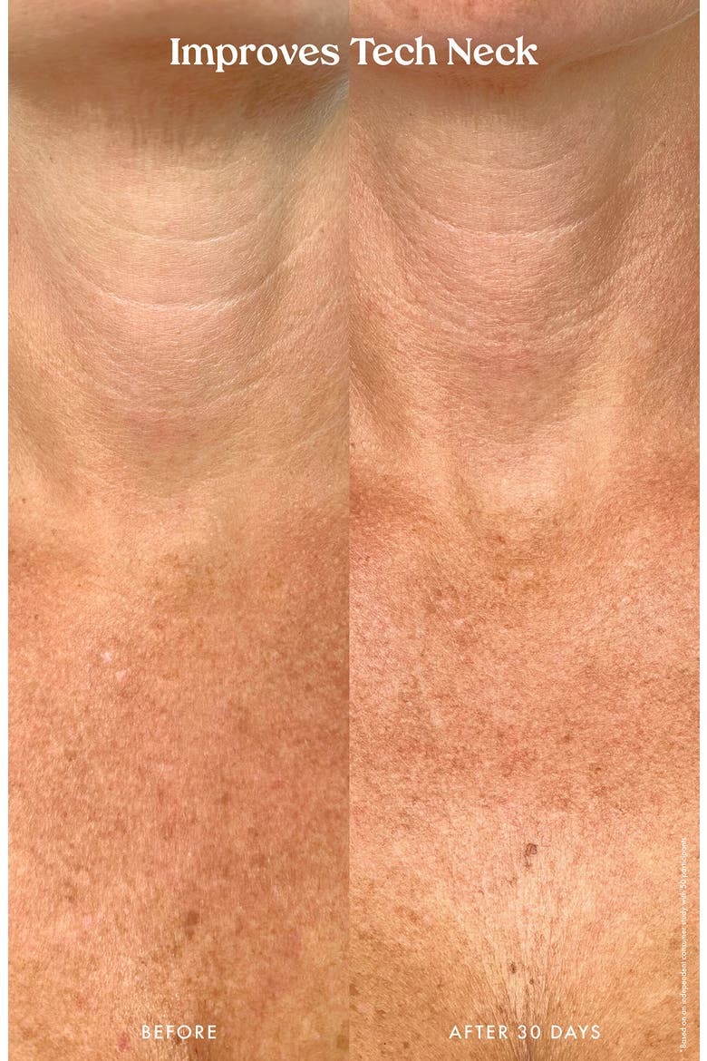 Ultra Renewal Retinol Body Cream, Alternate, color, NO COLOR