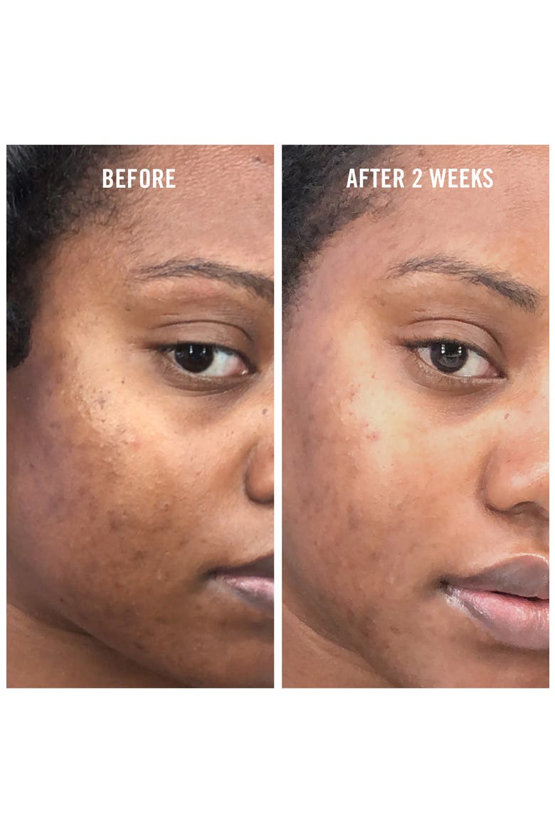 Facial Radiance Niacinamide Dark Spot Serum, Alternate, color, NO COLOR