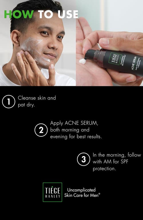 TIEGE HANLEY TIEGE HANLEY ACNE SERUM