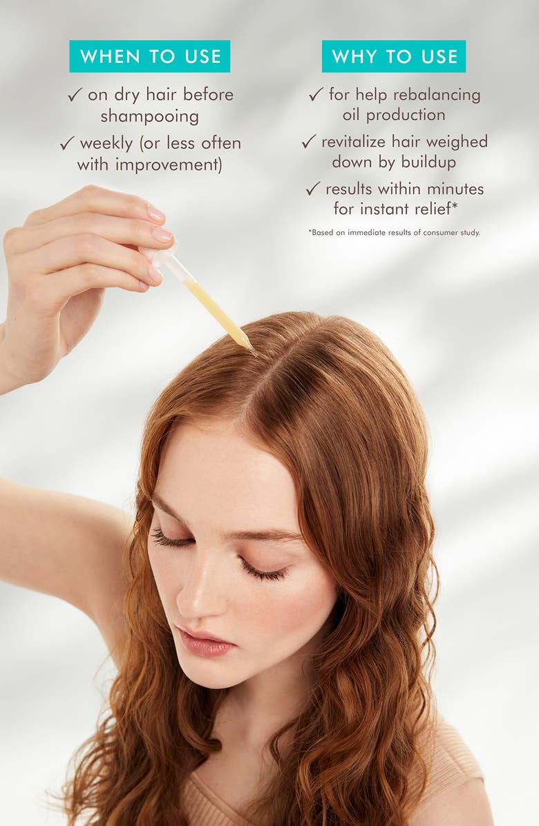 MOROCCANOIL<sup>®</sup> Oily Scalp Treatment, Alternate, color,