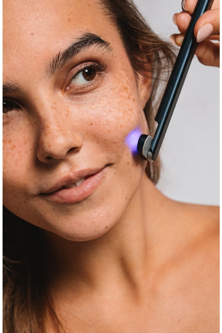 Blue Light Therapy Wand, Alternate, color, NAVY BLUE