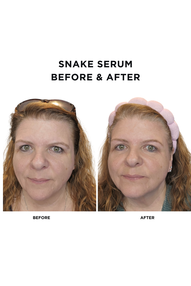 Snake Serum + Intoxicated Cosmetics Hat Bundle | 1 fl oz/ 30 ml | Anti-Aging Formula with Vegan Snake Peptides | Hydrating Hyaluronic Acid | Niacinamide for Radiant Skin Repair, Alternate, color, None