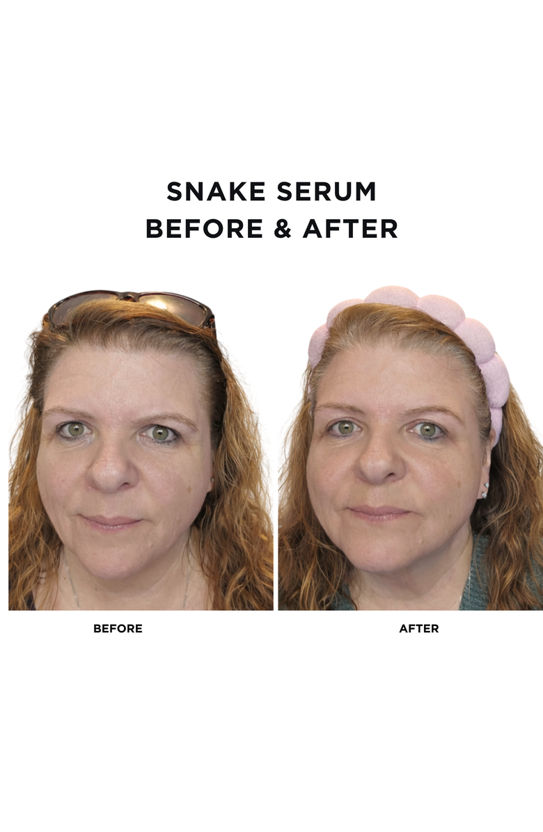 Intoxicated Cosmetics Snake Serum + Intoxicated Cosmetics Hat Bundle | 1 fl oz/ 30 ml | Anti-Aging Formula with Vegan Snake Peptides | Hydrating Hyaluronic Acid | Niacinamide for Radiant Skin Repair, Alternate, color, NO COLOR