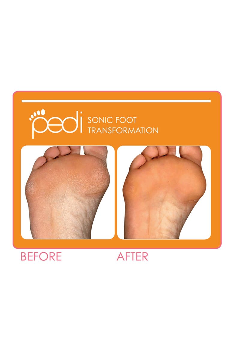 'Pedi' Sonic Foot Transformation, Alternate, color, NO COLOR