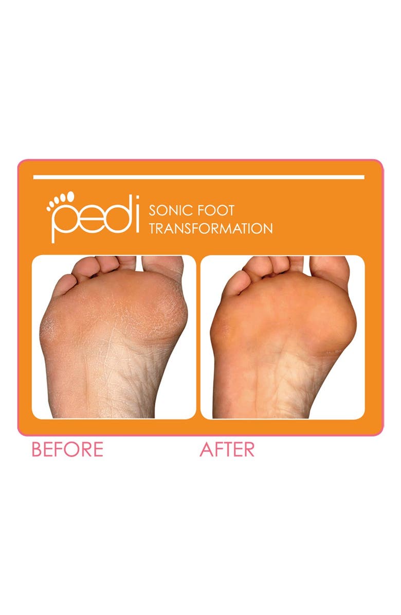 CLARISONIC 'Pedi' Sonic Foot Transformation, Alternate, color, 