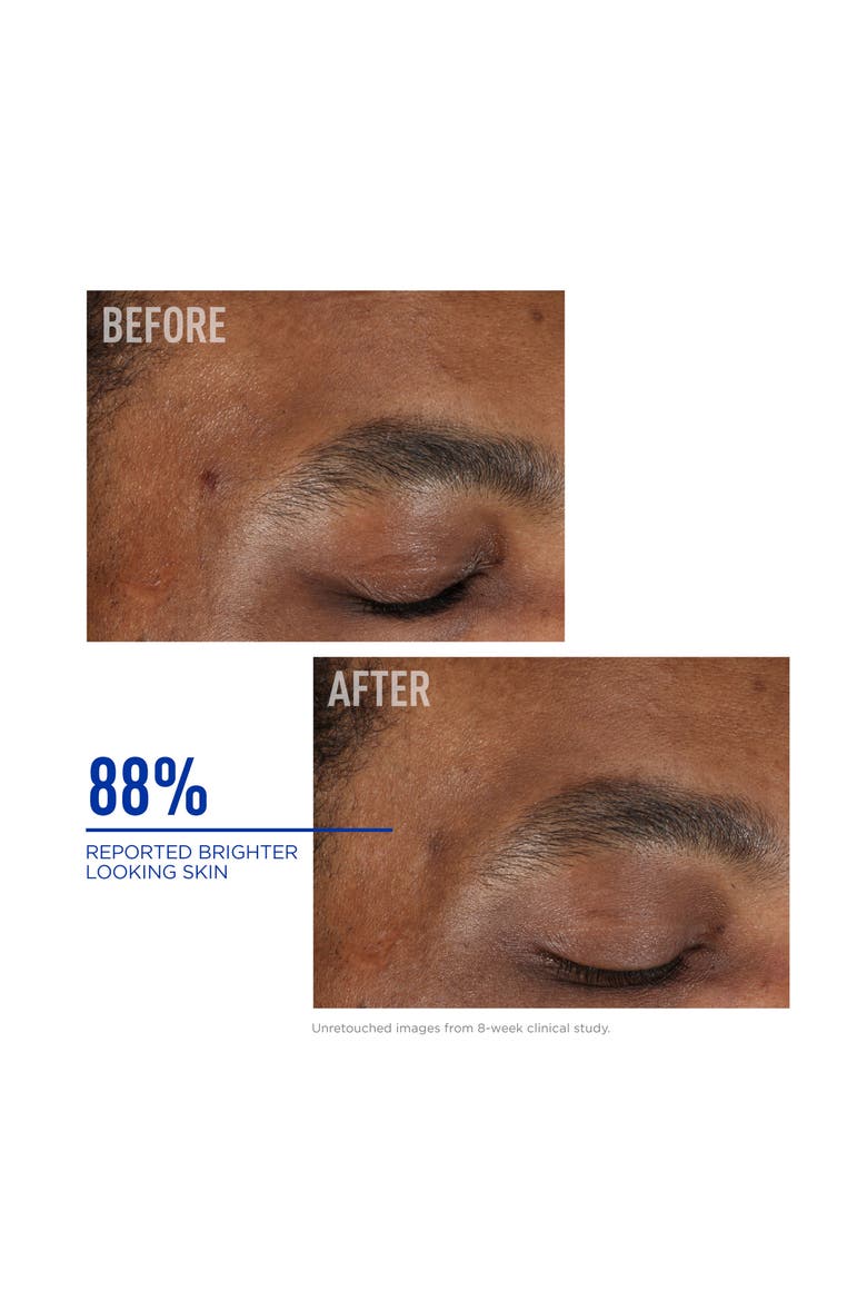 Nighttime BAK-Up™ Retinol Alternative, Alternate, color, NO COLOR