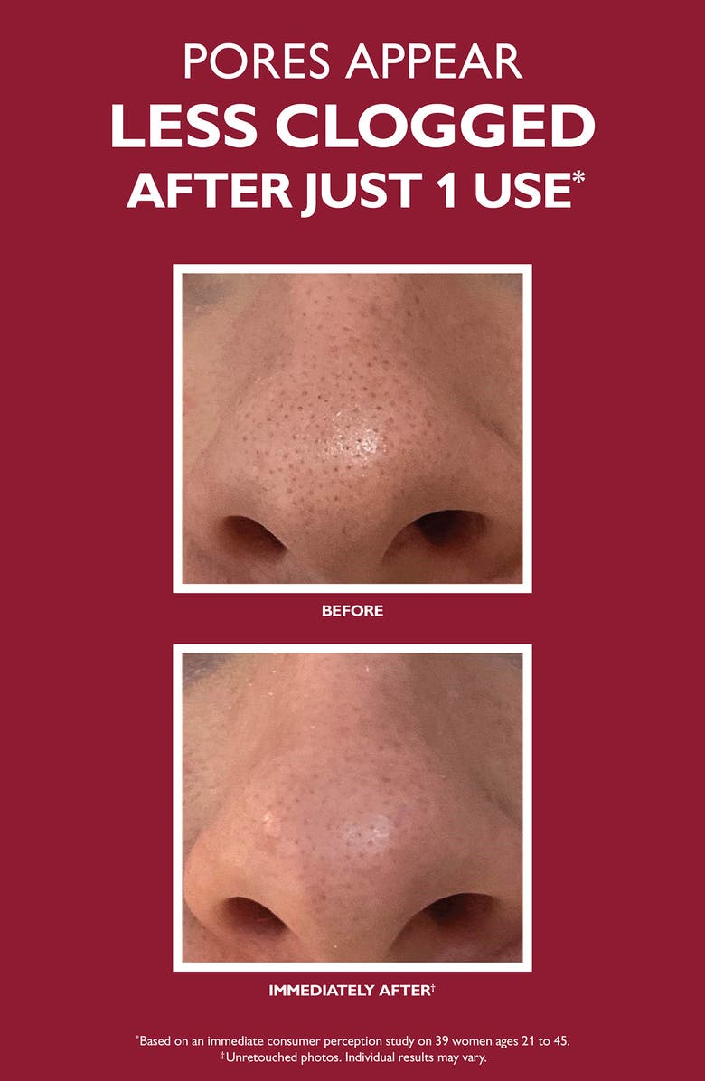 Peter Thomas Roth Even Smoother Microdermabrasion Exfoliating Pore Treatment, Alternate, color, 