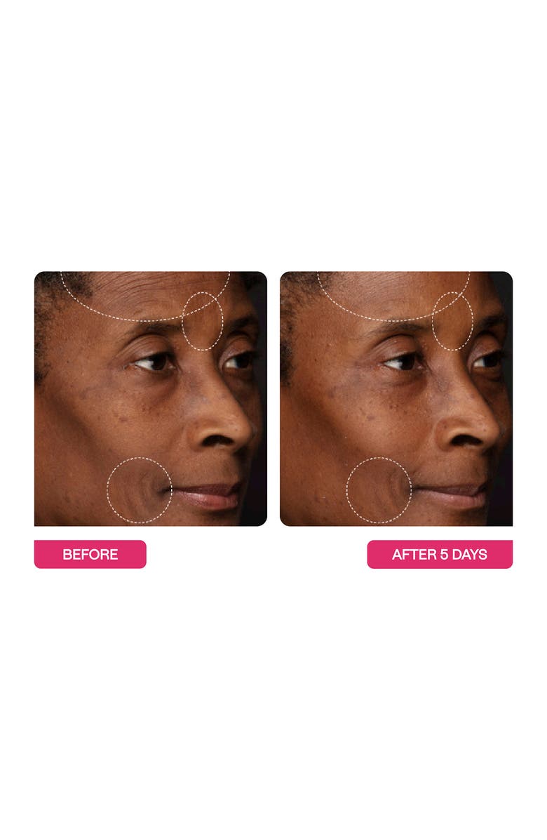 BeautyStat Peptide Wrinkle Relaxing Moisturizer, Alternate, color, 