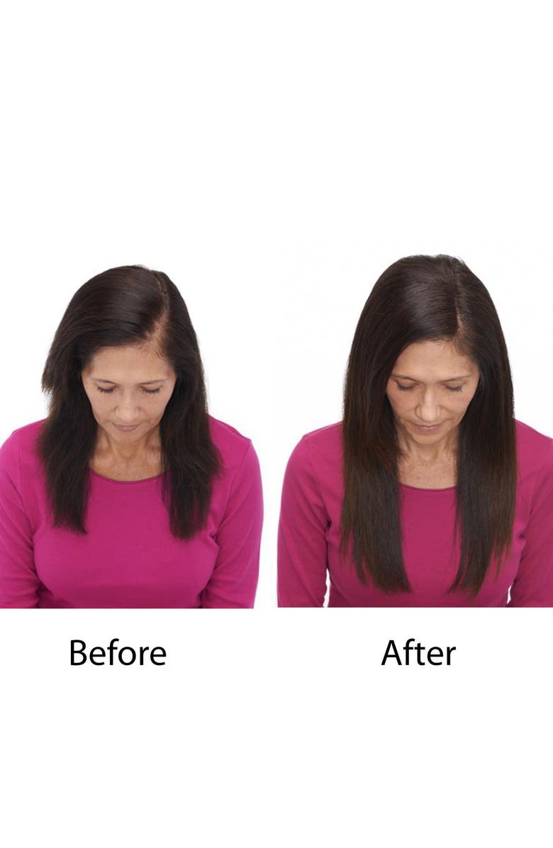 Keranique Deluxe Regrowth Treatment & Deep Hydration Set, Alternate, color,