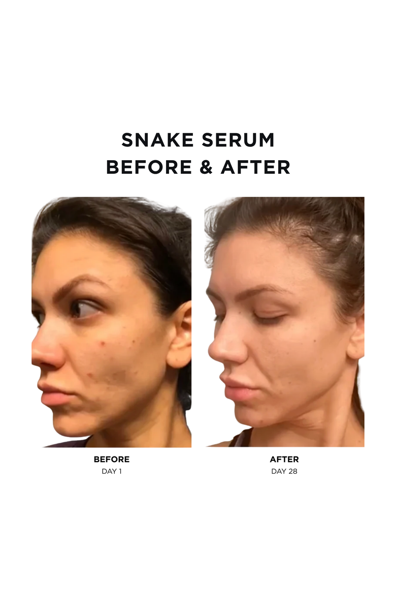 Intoxicated Cosmetics Snake Serum + Antidote Moisturizer | Anti-Aging Formula with Vegan Snake Peptides &  Fine Line Smoothing in a Hydrating Daily Moisturizer, Alternate, color, NO COLOR