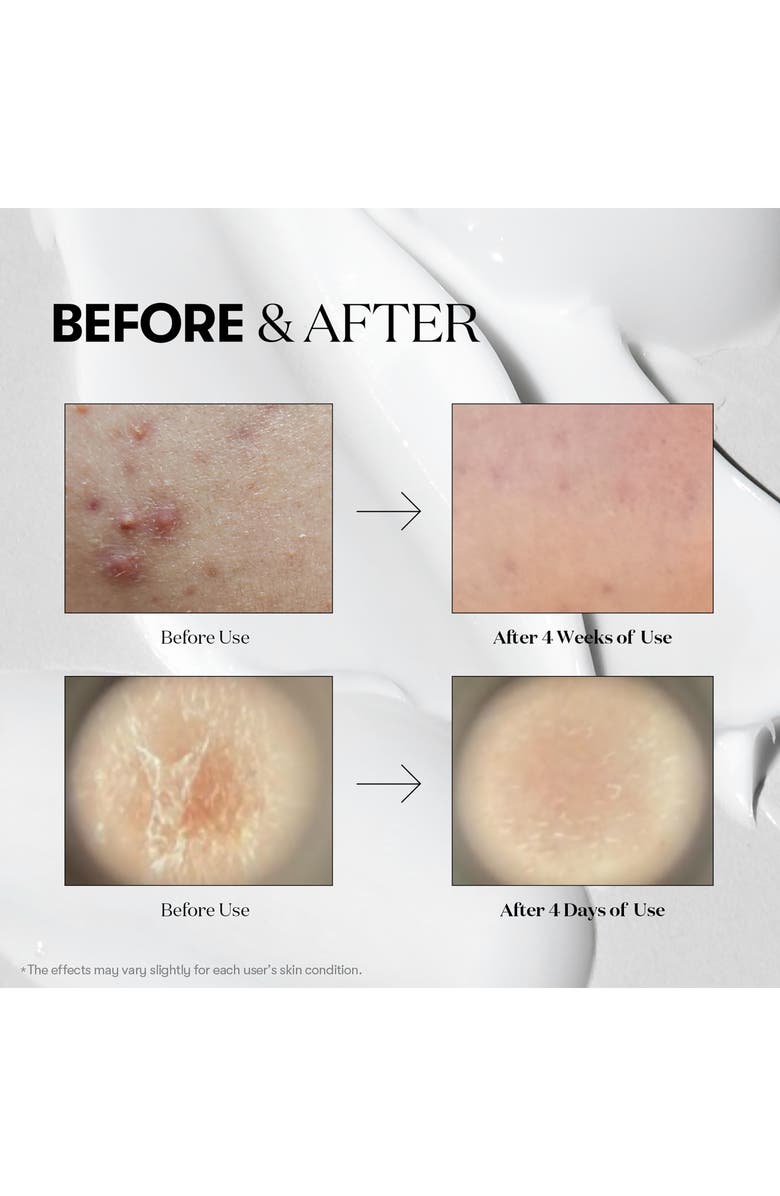 VT COSMETICS Reedle Shot<sup>™</sup> 100, Alternate, color, Silver