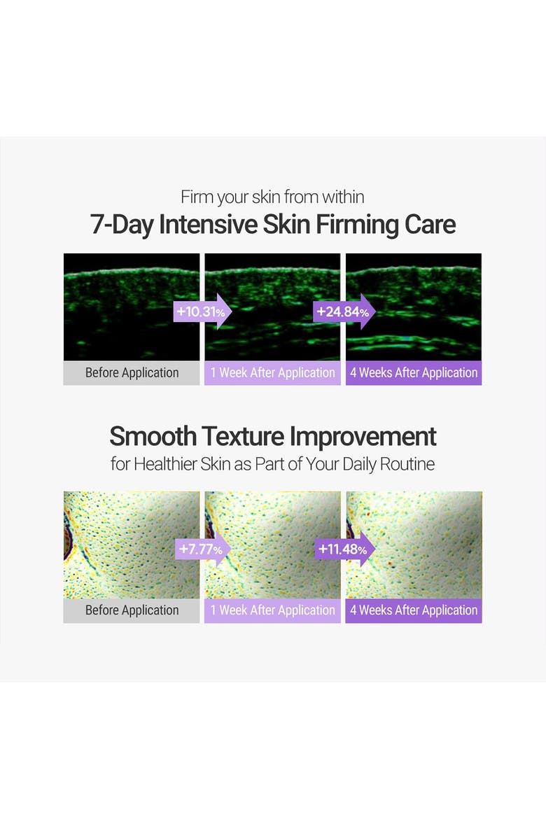 Retinosine Deep Intense Cream, Alternate, color, 1.01 fl. oz