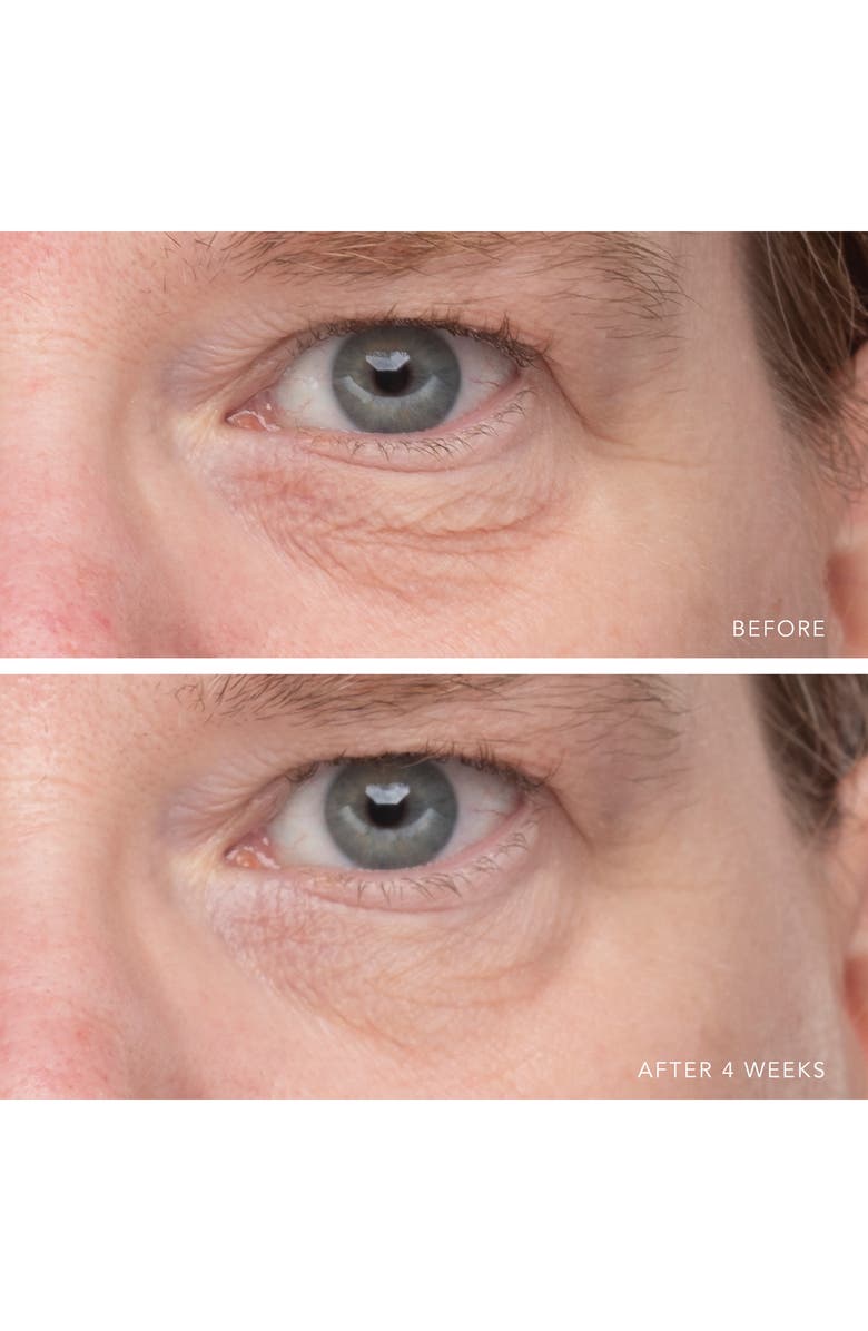 LANCER Skincare Ultra Hydrating Serum with Hyaluronic Complex-7, Alternate, color,