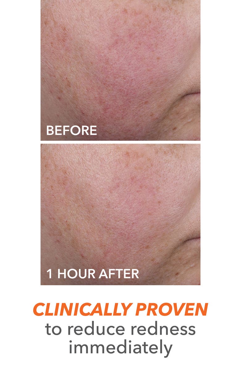 Dr. Dennis Gross Skincare DermInfusions Blur + Repair Cream, Alternate, color, Regular