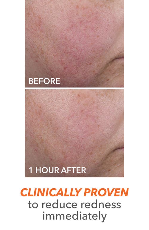 Dr Dennis Gross Skincare Dr. Dennis Gross Skincare Derminfusions Blur + Repair Cream In Regular