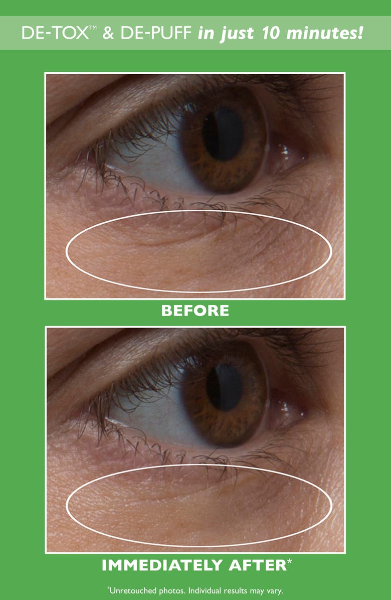 Peter Thomas Roth Cucumber De-Tox<sup>™</sup> Hydra-Gel Eye Patches, Alternate, color,