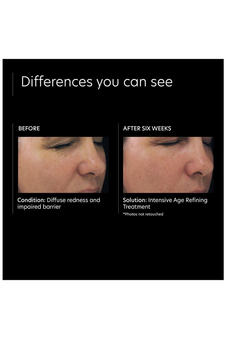 Intensive Age Refining Treatment, Alternate, color, NO COLOR
