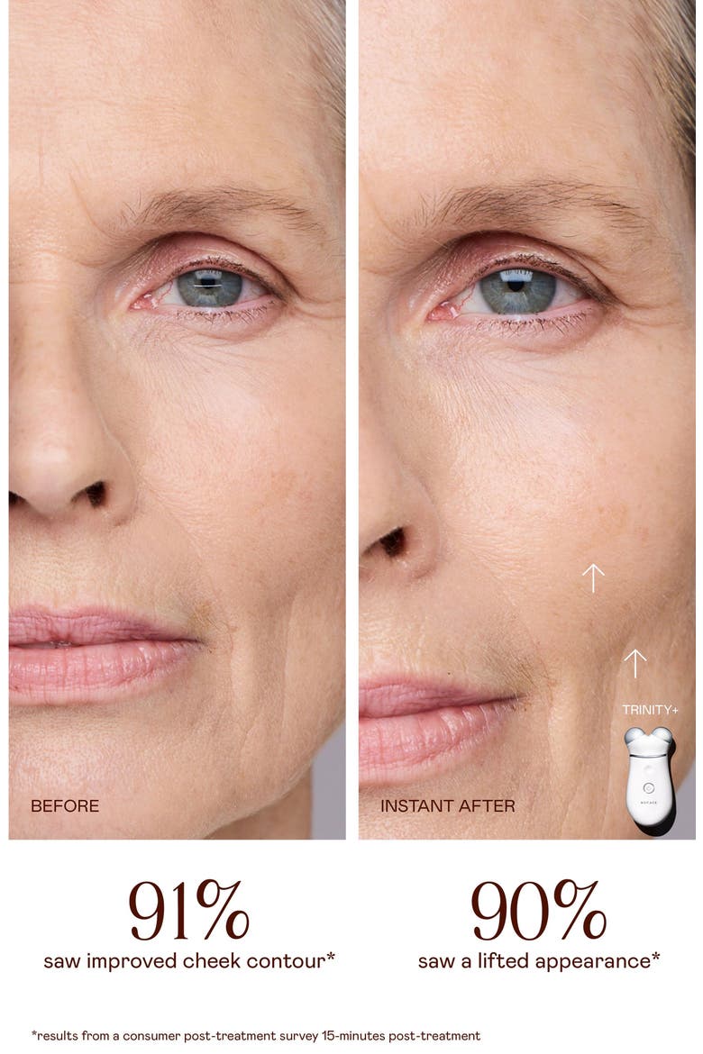 TRINITY+ Microcurrent Facial Toning Device with LED Red Light Attachment, Alternate, color, NO COLOR