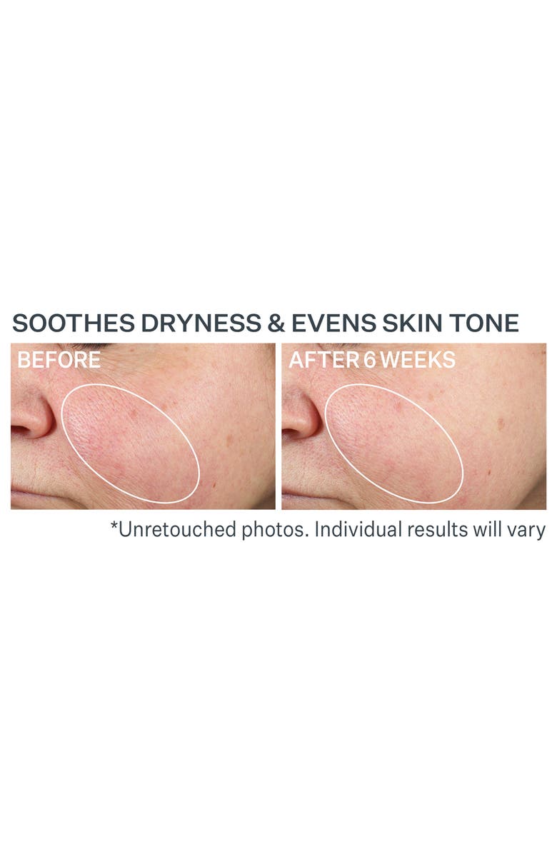 StriVectin<sup>®</sup> Multi-action Super-B Barrier Strengthening Oil, Alternate, color, 