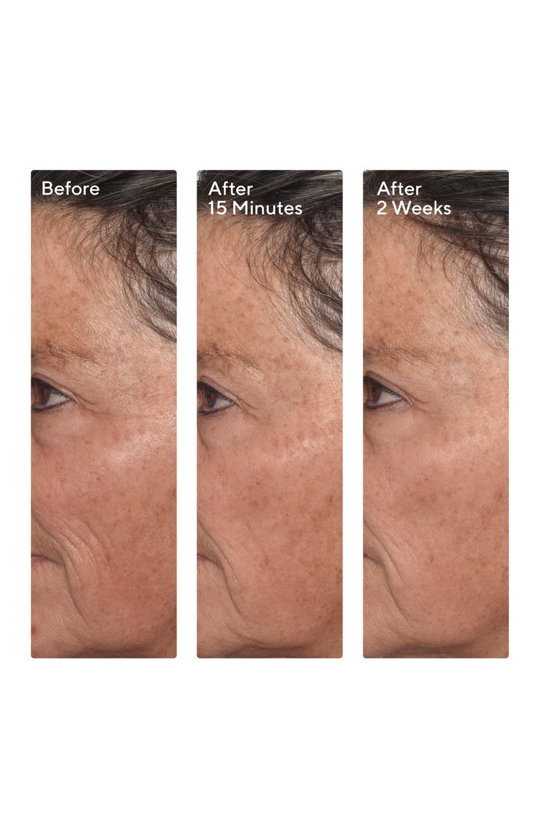 Murad<sup>®</sup> Targeted Wrinkle Corrector, Alternate, color,