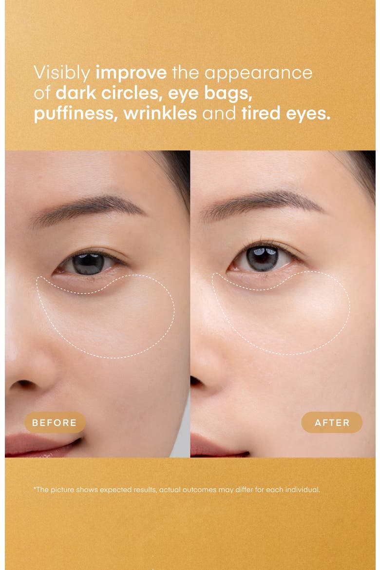 24K Gold Retinol Eye Gel Patch, Alternate, color, Gold