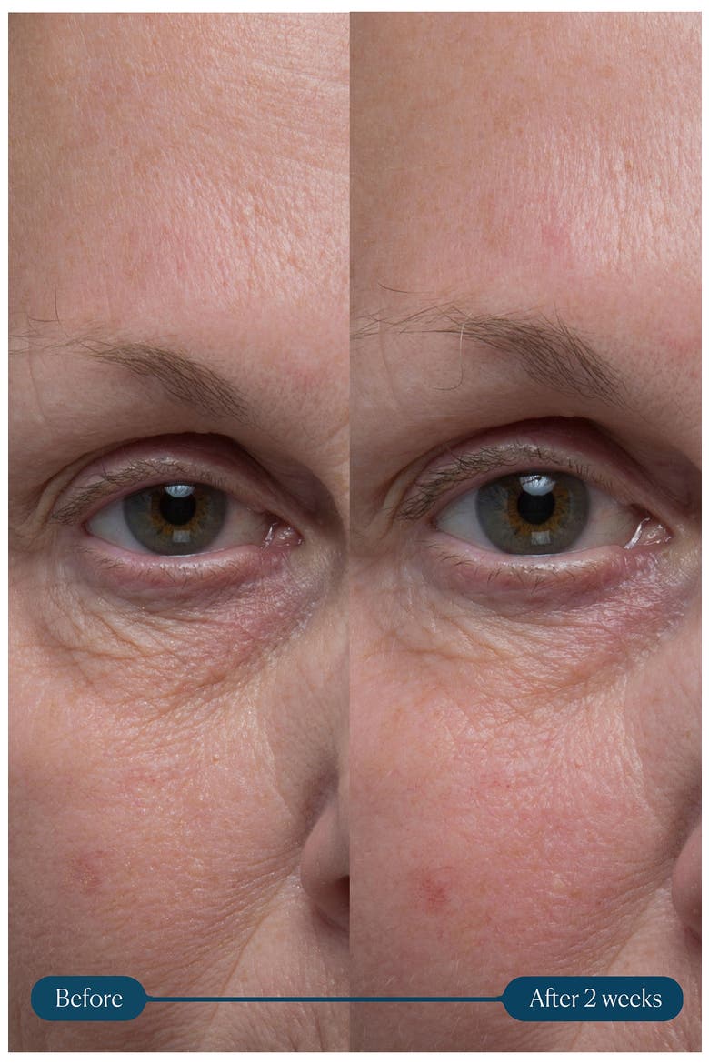 Pro-Collagen Vitality Eye Cream, Alternate, color, NO COLOR