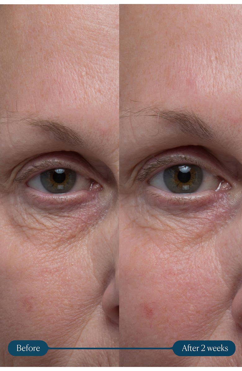 Elemis Pro-Collagen Vitality Replenishing Eye Cream, Alternate, color, 