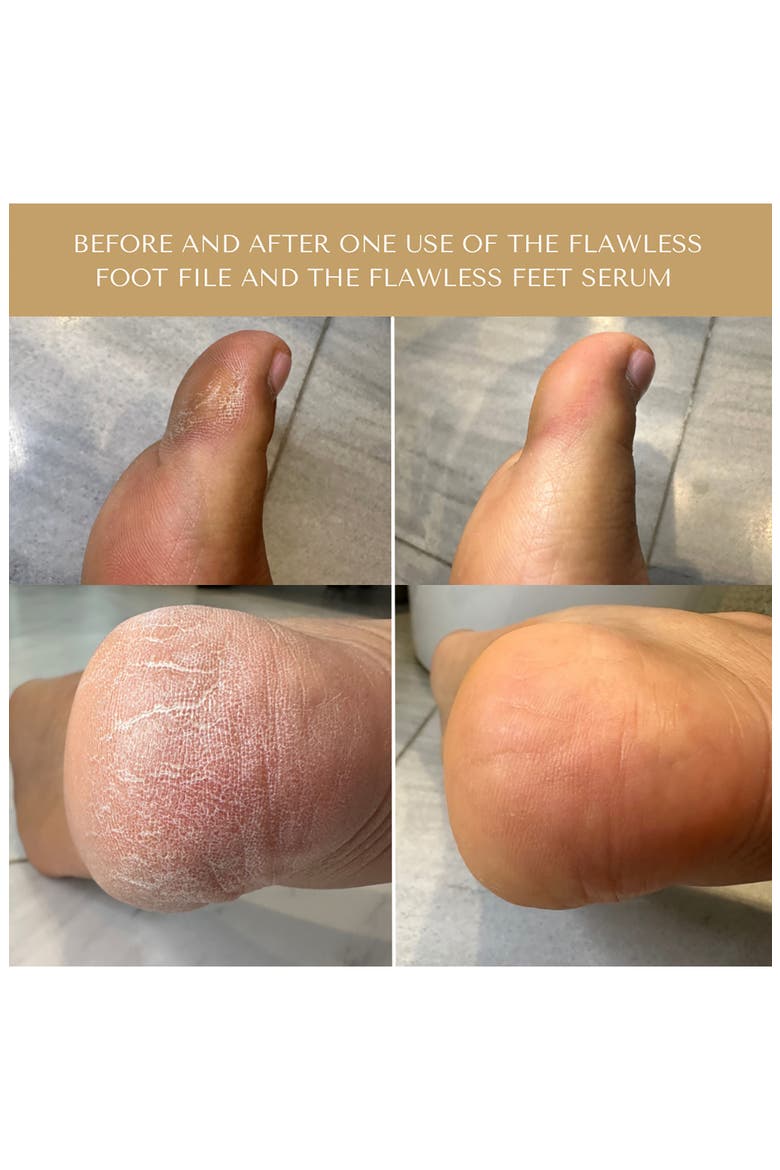 Flawless Feet System, Alternate, color, GREEN