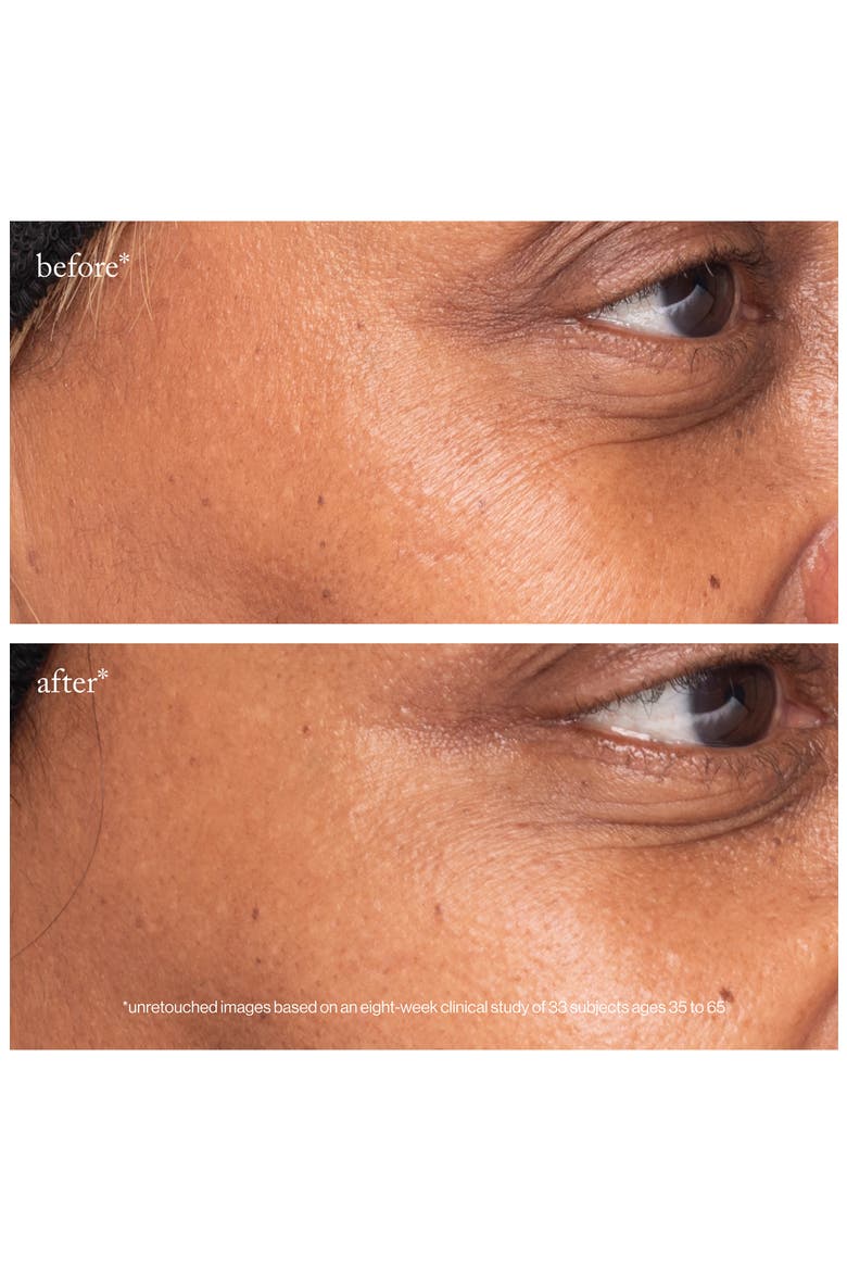 3X Retinol Eye Lift Serum, Alternate, color, NO COLOR