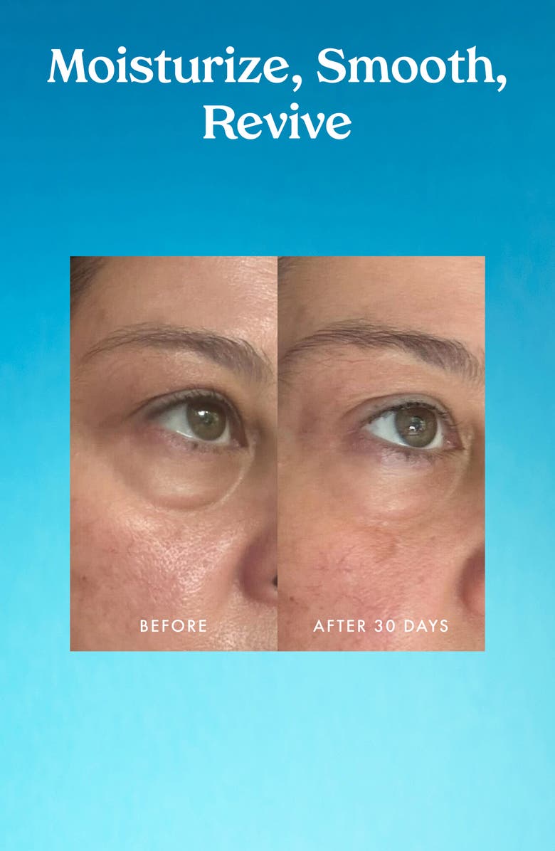 Kopari Ceramide & Retinol Dual-Core Eye Balm, Alternate, color, 