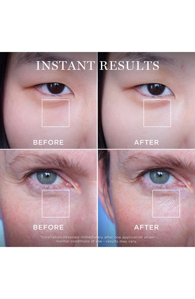 Lancôme The Glow of Génifique Set $192 Value, Alternate, color,