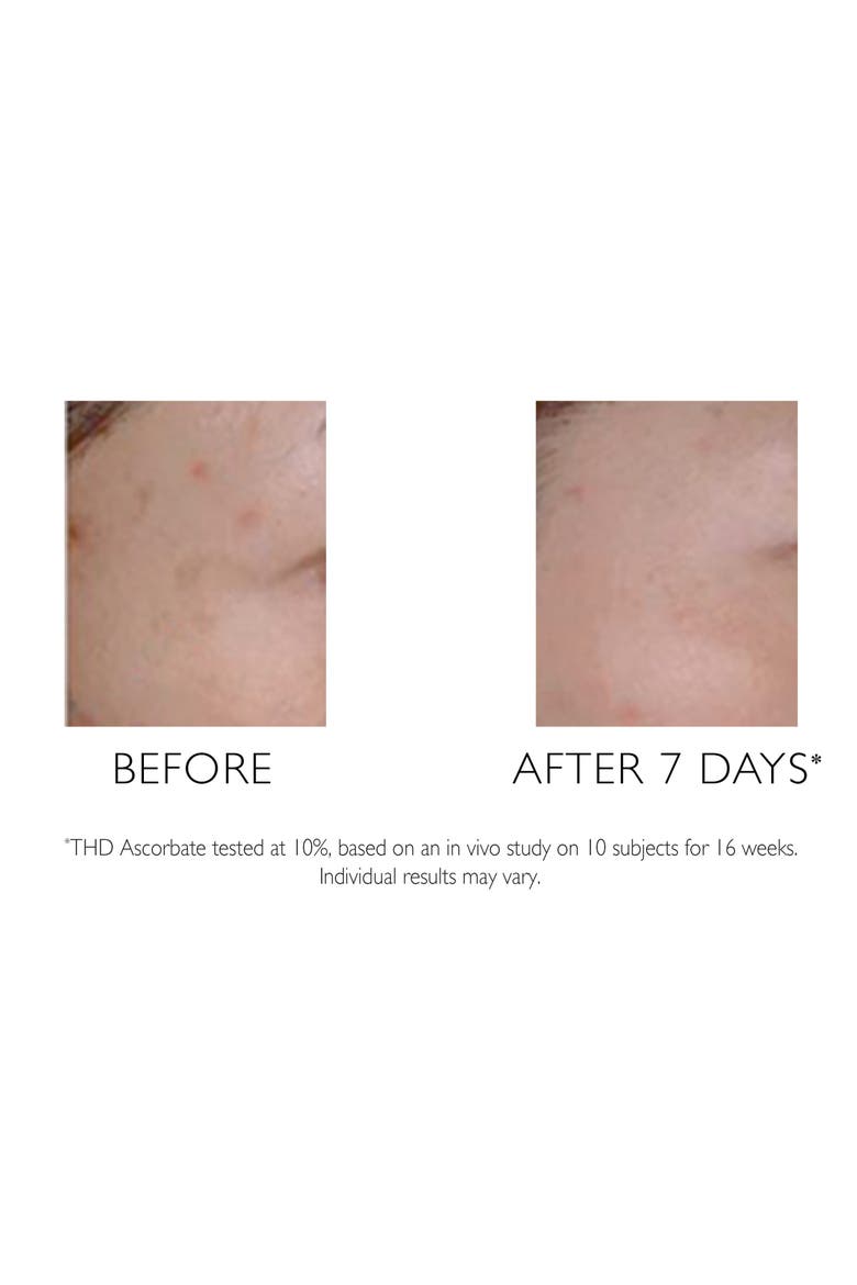 Potent-C Targeted Spot Brightener, Alternate, color, NO COLOR