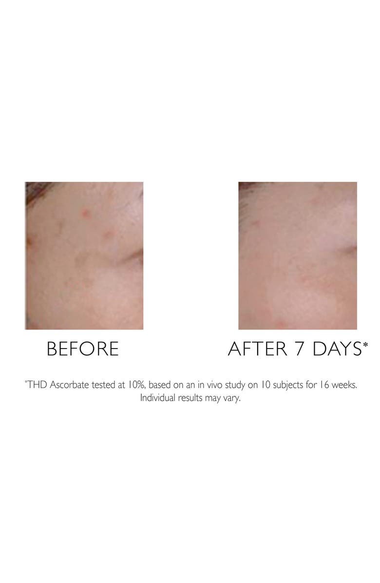 Peter Thomas Roth Potent-C Targeted Spot Brightener, Alternate, color,