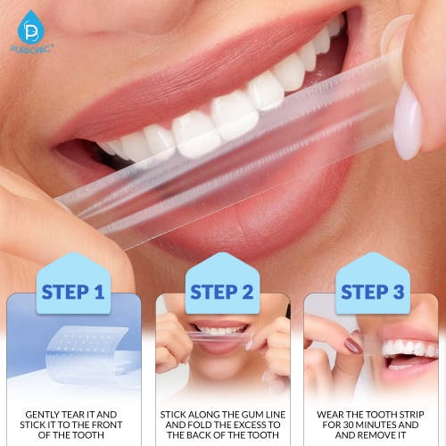 Pursonic Teeth Whitening Essentials Bundle In White