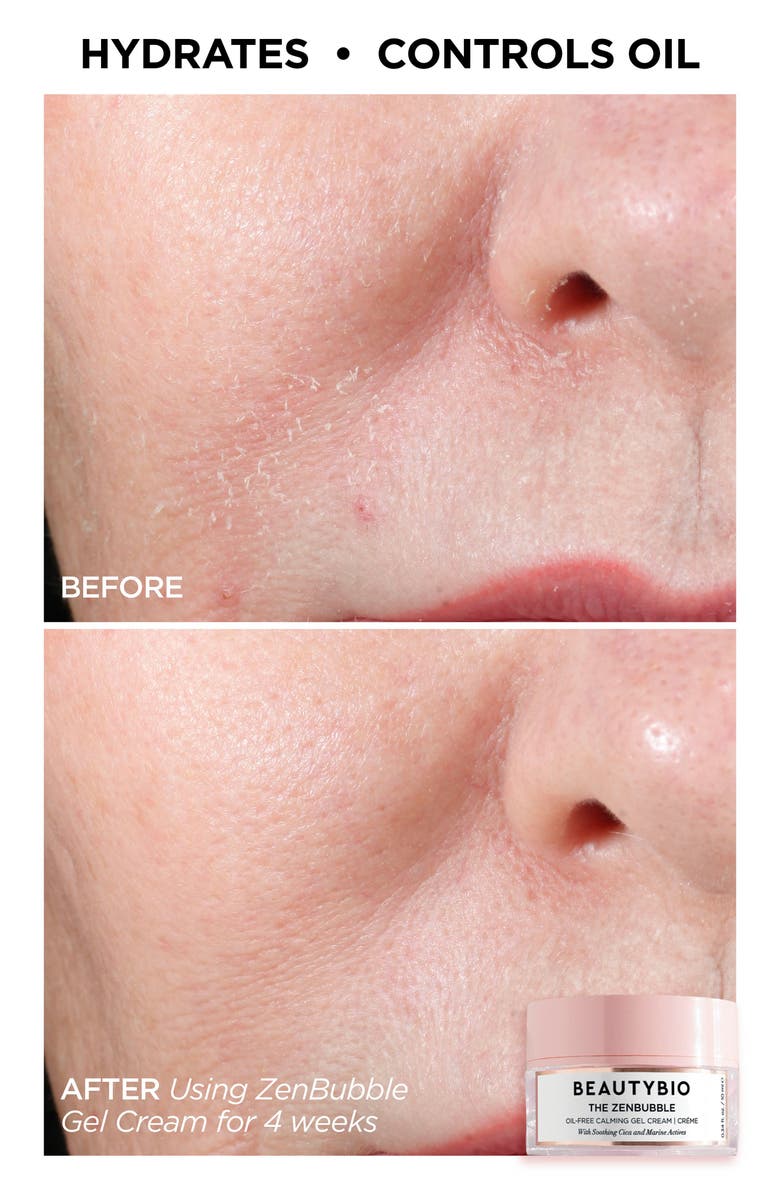 BeautyBio The Complete GloPRO<sup>®</sup> Set USD $422 Value, Alternate, color,