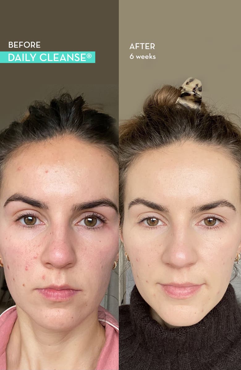 Hum Nutrition Daily Cleanse<sup>®</sup> Clear Skin and Body Detox Dietary Supplement, Alternate, color,