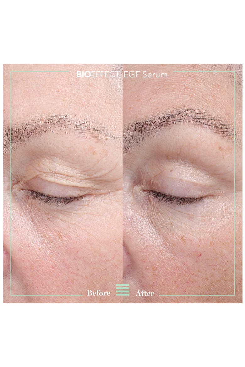 EGF Serum, Alternate, color, NONE