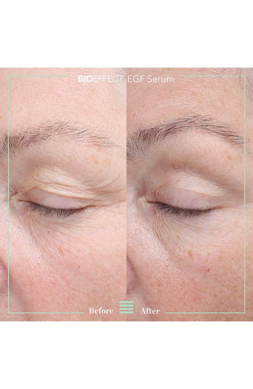 Bioeffect Egf Serum