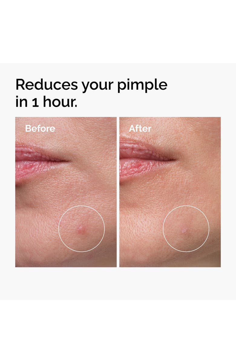 The Ordinary Sulfur 10% Powder-to-Cream Concentrate, Alternate, color, 