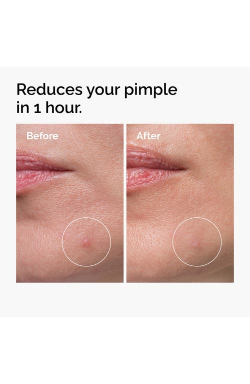 The Ordinary Sulfur 10% Powder-to-cream Concentrate In Transparent