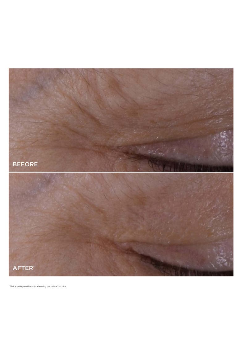 Double Serum® Eye Depuffing Set $134 Value, Alternate, color, NO COLOR