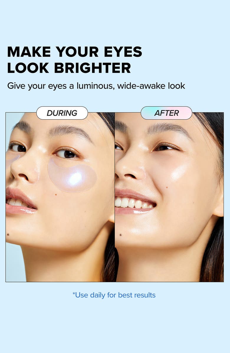 I DEW CARE Starlit Kitten 5-Pack Eye Patches, Alternate, color,