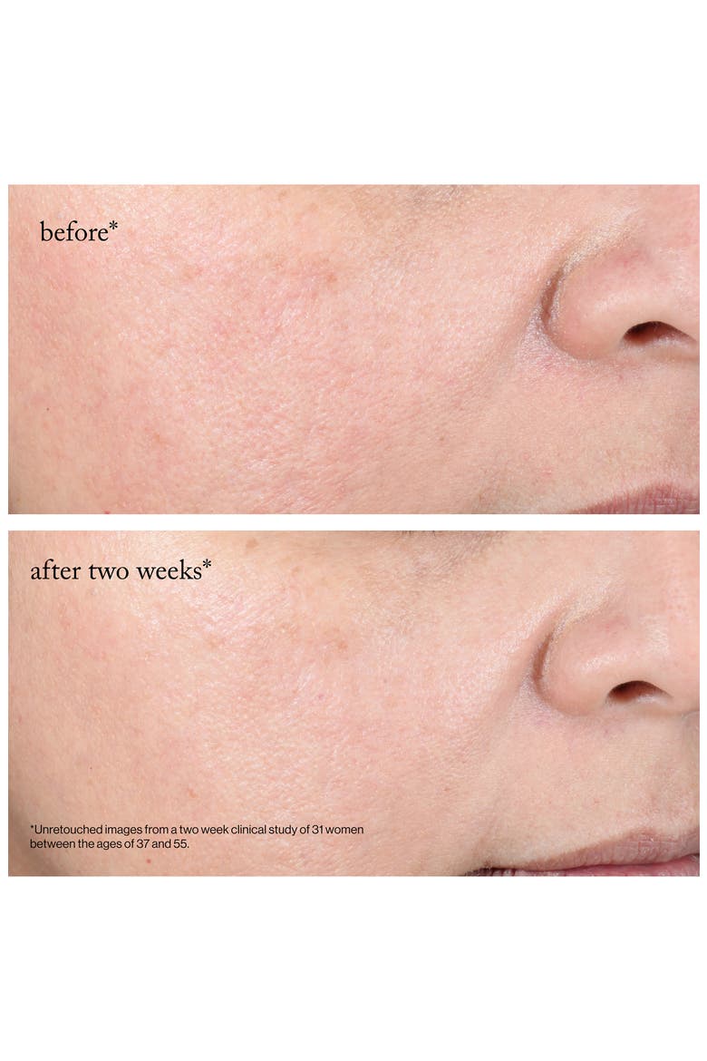 15% Glycolic Acid Overnight Glow Peel Pads - 12-Pack, Alternate, color, NO COLOR