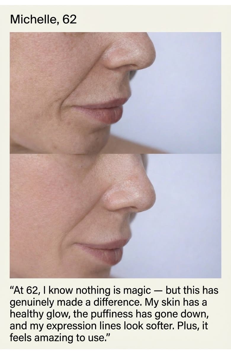 Lovery 2-in-1 LED Red Light Therapy Skincare Device with EMS & Vibration, Alternate, color, Pink