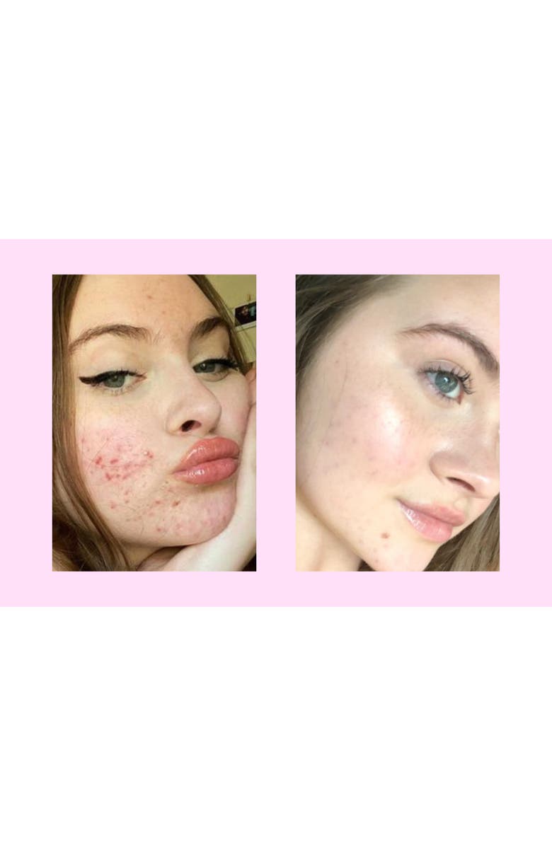 ROSEN Earth Cleanser, Alternate, color,