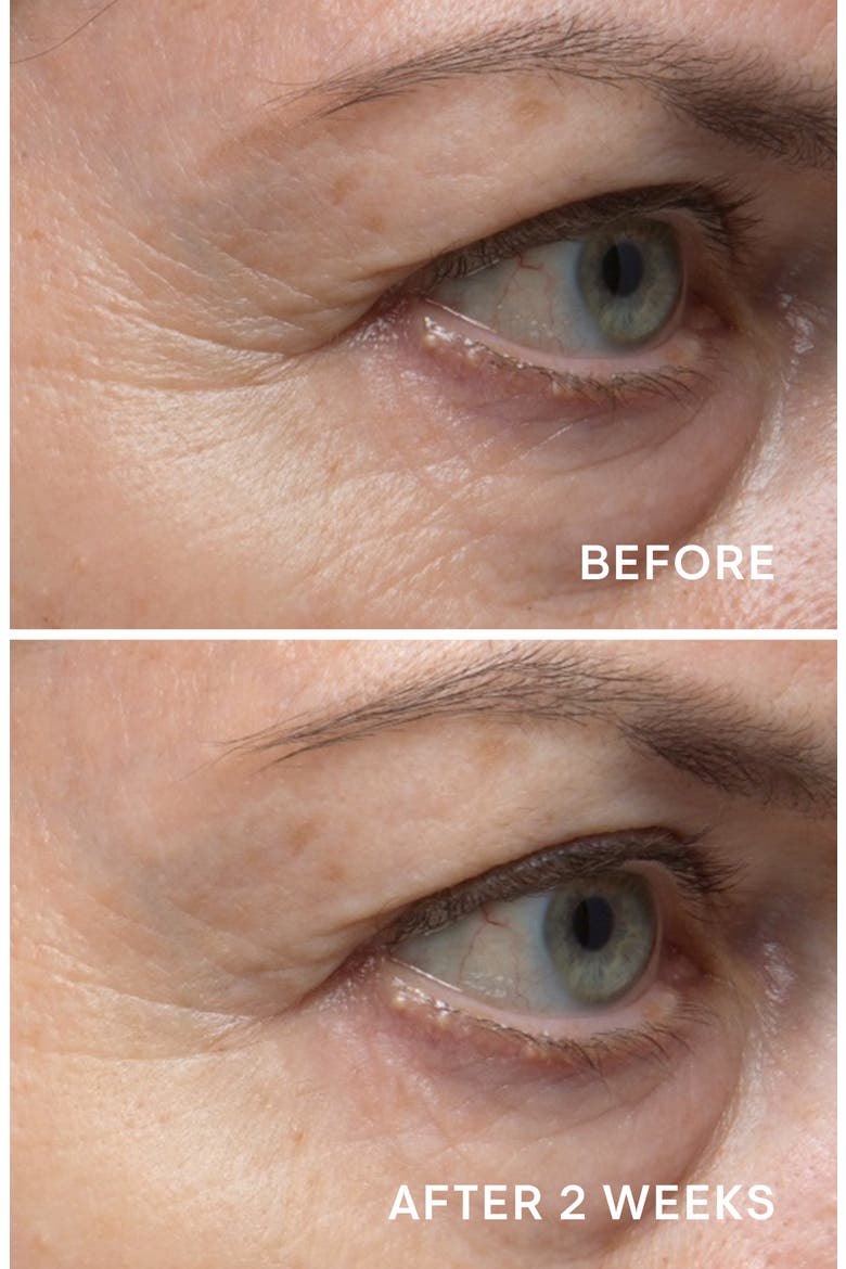Pro-Collagen Eye Revive Mask, Alternate, color, NO COLOR